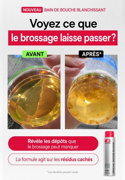 🦷💋Indispensable avant un baiser | IEY® 🎀iD Stain Whitening Mouthwash💋soin blanchiment dentaire