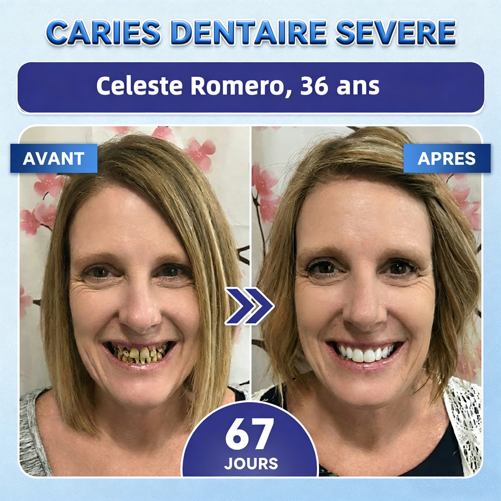 bigoGarageLine®🦷 TIDEGlUSIB TOOTH & GUM NanoRepair : bandelettes blanchissantes à dissolution rapide ✨ (Aide à soutenir la régénération dentaire et à soulager l’inconfort des gencives ainsi que d’autres problèmes bucco-dentaires courants)