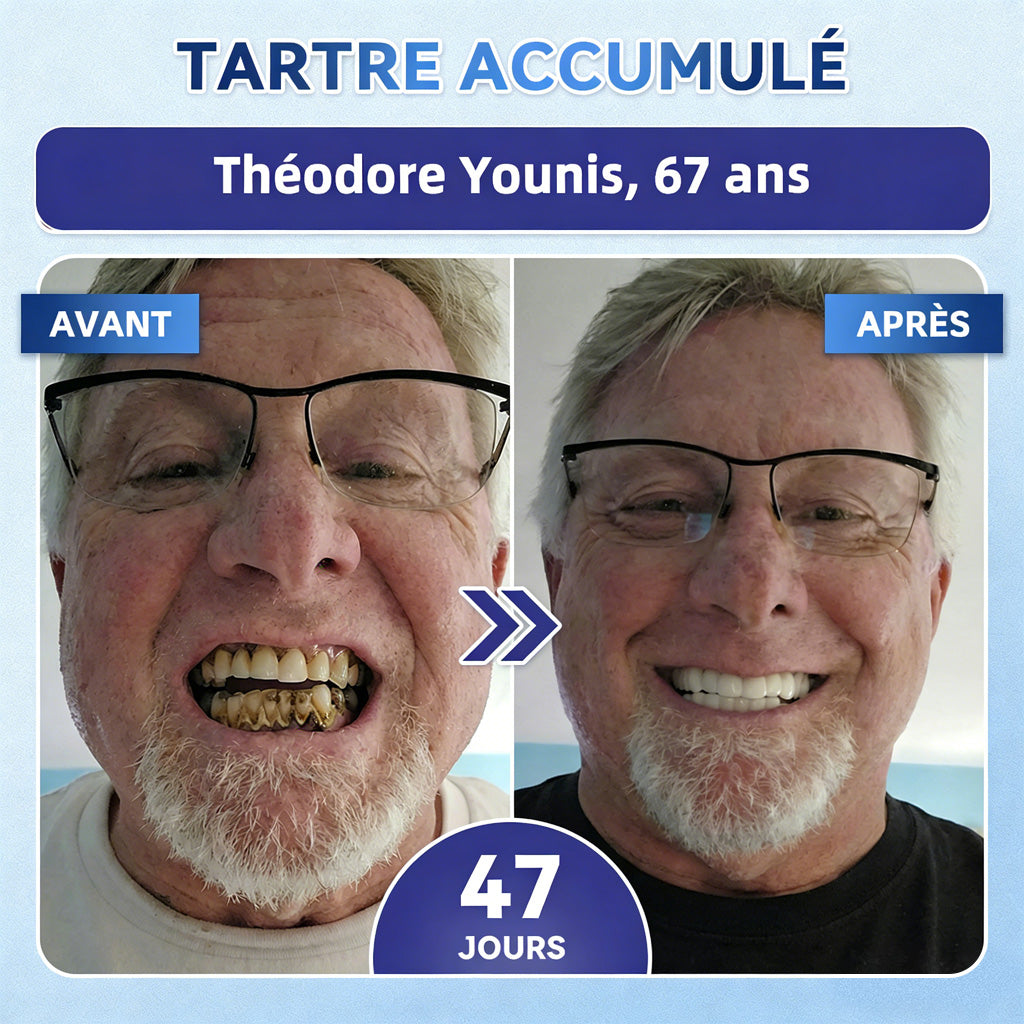 bigoGarageLine®🦷 TIDEGlUSIB TOOTH & GUM NanoRepair : bandelettes blanchissantes à dissolution rapide ✨ (Aide à soutenir la régénération dentaire et à soulager l’inconfort des gencives ainsi que d’autres problèmes bucco-dentaires courants)