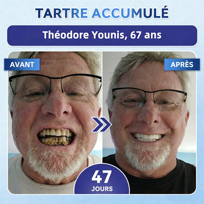 bigoGarageLine®🦷 TIDEGlUSIB TOOTH & GUM NanoRepair : bandelettes blanchissantes à dissolution rapide ✨ (Aide à soutenir la régénération dentaire et à soulager l’inconfort des gencives ainsi que d’autres problèmes bucco-dentaires courants)