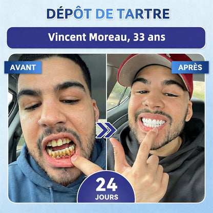 bigoGarageLine®🦷 TIDEGlUSIB TOOTH & GUM NanoRepair : bandelettes blanchissantes à dissolution rapide ✨ (Aide à soutenir la régénération dentaire et à soulager l’inconfort des gencives ainsi que d’autres problèmes bucco-dentaires courants)